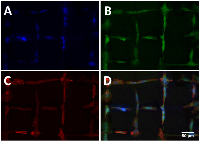 Fig. 1 Different immunostaining images of neurons grown on UNCD with patterned surface modification (D is an overlay of A-C). The neurons follow the hydrophilic paths (oxygen terminated) and avoid the hydrophobic regions (fluorine terminated). 