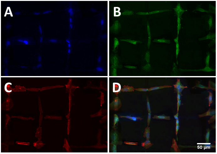 Abb. 1 Verschiedene Immunfärbungen von Neuronen, die auf UNCD gewachsen sind (D ist ein Overlay von A-C). Die Neuronen wachsen entlang der hydrophilen Pfade (Sauerstoffterminiert) und meiden die hydrophoben Bereiche (Fluorterminiert). 