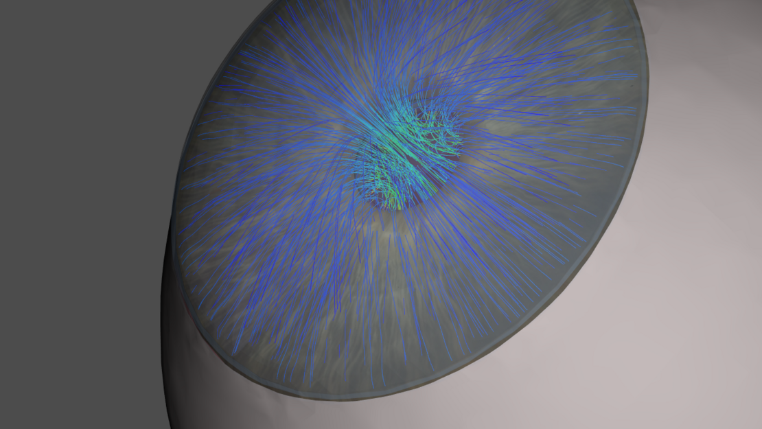 Das Virtuelle Auge: Aufbau einer realistischen Geometrie mithilfe mathematischer Funktionen und Abbildung der Physiologie (z. B. Organbeschaffenheit oder Kammerwasserströmung) durch Modelle der Kontinuumsmechanik sowie Finite-Elemente-Simulationen.